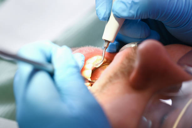 Best Knocked-Out Tooth Emergency  in Harker Heights, TX