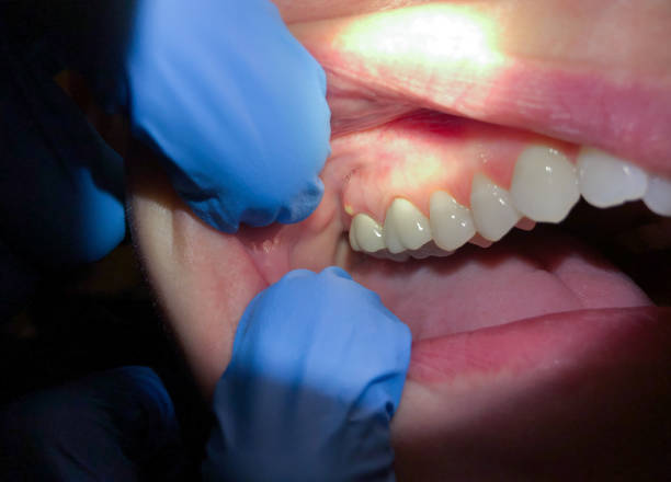 Best Knocked-Out Tooth Emergency  in Harker Heights, TX