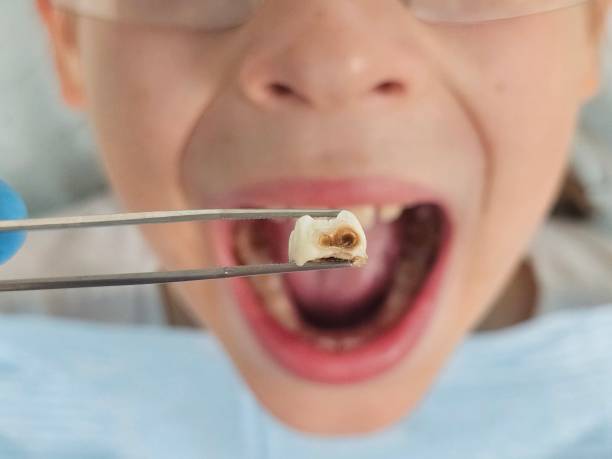 Best Tooth Pain Emergency Relief  in Harker Heights, TX